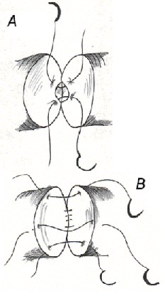 VE1