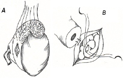 VE2