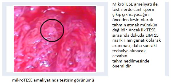 mikro_tese