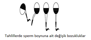 sperm_boyutu_3