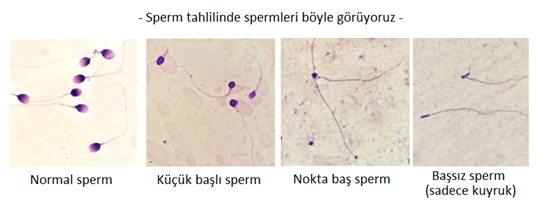 sperm_boyutu_4